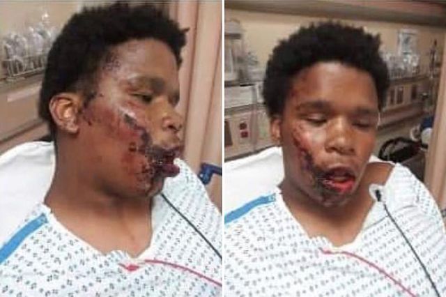 Two photos of Jahmel Leach, a 16-year-old boy, stand side by side of each other, showing a bloody gash to the right side of his face beginning at his cheek and running down toward his chin.